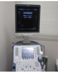 写真:超音波検査機器